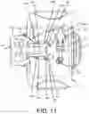 Fig. 18 - Pump assembly for a penile prosthesis