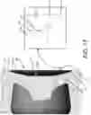 Fig. 24 - Pump assembly for a penile prosthesis