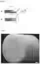 Fig. 04 - MEDICAL USE HONEYCOMB STRUCTURE