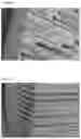 Fig. 08 - MEDICAL USE HONEYCOMB STRUCTURE