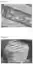 Fig. 11 - MEDICAL USE HONEYCOMB STRUCTURE