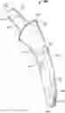 Fig. 01 - Self-Broaching Neck Preserving Hip Stem
