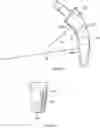 Fig. 03 - Self-Broaching Neck Preserving Hip Stem