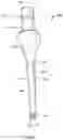 Fig. 04 - Self-Broaching Neck Preserving Hip Stem