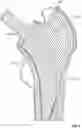 Fig. 07 - Self-Broaching Neck Preserving Hip Stem