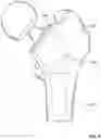 Fig. 08 - Self-Broaching Neck Preserving Hip Stem