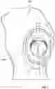 Fig. 09 - Self-Broaching Neck Preserving Hip Stem