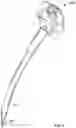 Fig. 10 - Self-Broaching Neck Preserving Hip Stem