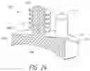 Fig. 15 - Augmented glenoid components and devices for implanting the same