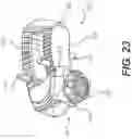 Fig. 20 - Stabilized intervertebral spacer
