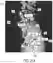 Fig. 47 - COMPUTER-ASSISTED ARTHROPLASTY SYSTEM TO IMPROVE PATELLAR PERFORMANCE