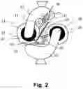 Fig. 03 - ORTHOPEDIC JOINT DEVICE