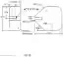 Fig. 04 - Stent removal snare and dilator