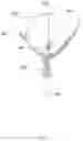 Fig. 05 - Stent removal snare and dilator