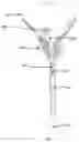 Fig. 06 - Stent removal snare and dilator