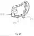 Fig. 11 - Delivery apparatus and system