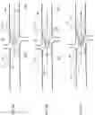 Fig. 11 - Acute and chronic devices for modifying flow in body lumens and methods of use thereof