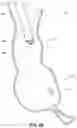 Fig. 06 - OBESITY TREATMENT DEVICES, SYSTEMS, AND METHODS