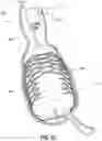 Fig. 08 - OBESITY TREATMENT DEVICES, SYSTEMS, AND METHODS