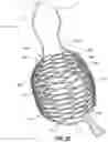 Fig. 10 - OBESITY TREATMENT DEVICES, SYSTEMS, AND METHODS