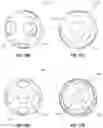 Fig. 20 - OBESITY TREATMENT DEVICES, SYSTEMS, AND METHODS