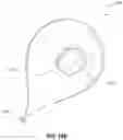 Fig. 23 - OBESITY TREATMENT DEVICES, SYSTEMS, AND METHODS