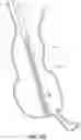 Fig. 47 - OBESITY TREATMENT DEVICES, SYSTEMS, AND METHODS