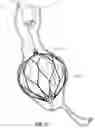 Fig. 49 - OBESITY TREATMENT DEVICES, SYSTEMS, AND METHODS