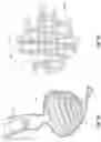 Fig. 62 - OBESITY TREATMENT DEVICES, SYSTEMS, AND METHODS