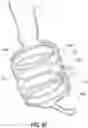 Fig. 68 - OBESITY TREATMENT DEVICES, SYSTEMS, AND METHODS