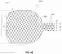 Fig. 71 - OBESITY TREATMENT DEVICES, SYSTEMS, AND METHODS