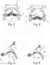Fig. 03 - Device for supporting at least one arm of a user, and headrest