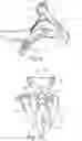 Fig. 04 - Device for supporting at least one arm of a user, and headrest