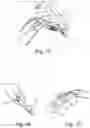 Fig. 06 - Device for supporting at least one arm of a user, and headrest