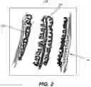 Fig. 03 - Rigidifying brace