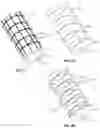 Fig. 05 - FLUID COLLECTION ASSEMBLIES INCLUDING AT LEAST ONE SHAPE MEMORY MATERIAL DISPOSED IN THE CONDUIT