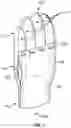Fig. 02 - Fingertip warming device for increasing circulation