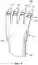 Fig. 14 - Fingertip warming device for increasing circulation
