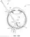 Fig. 09 - VACUUM-ASSISTED FORCEPS FOR OPHTHALMIC PROCEDURES