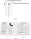 Fig. 05 - SMART AUXILIARY DIAGNOSIS SYSTEM AND METHOD FOR FUNDUS OCULI LASER SURGERY