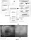 Fig. 07 - SMART AUXILIARY DIAGNOSIS SYSTEM AND METHOD FOR FUNDUS OCULI LASER SURGERY