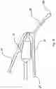 Fig. 11 - ONE-PIECE ADAPTOR DEVICE FOR OCULAR INSTILLATION OF OPHTHALMIC DROPS FROM A CONTAINER
