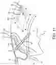 Fig. 16 - SURGICAL SYSTEM AND PROCEDURE FOR TREATMENT OF THE TRABECULAR MESHWORK AND SCHLEMM'S CANAL USING A FEMTOSECOND LASER