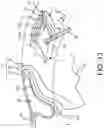 Fig. 18 - SURGICAL SYSTEM AND PROCEDURE FOR TREATMENT OF THE TRABECULAR MESHWORK AND SCHLEMM'S CANAL USING A FEMTOSECOND LASER