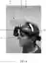 Fig. 09 - Ophthalmoscope mounted face shield