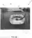 Fig. 03 - WOUND DRESSING WITH SELECTIVE AND DYNAMIC TRANSPARENCY