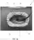 Fig. 06 - WOUND DRESSING WITH SELECTIVE AND DYNAMIC TRANSPARENCY