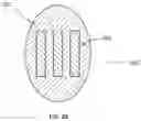 Fig. 03 - DEVICES AND METHODS FOR TREATING AND CLOSING WOUNDS WITH NEGATIVE PRESSURE