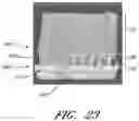 Fig. 16 - WOUND DRESSING AND METHOD OF USE