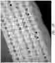 Fig. 18 - WOUND DRESSING AND METHOD OF USE